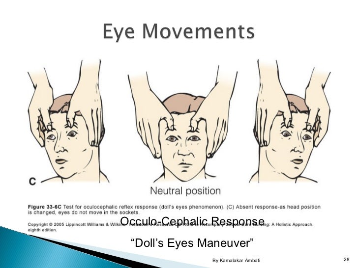 Brain death assessment basic principles