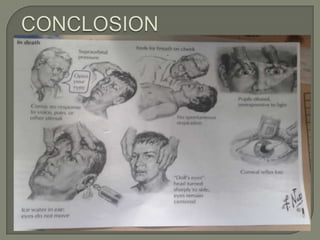 Brain death critiria