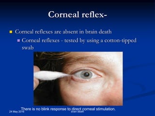 Corneal reflex-
 Corneal reflexes are absent in brain death
 Corneal reflexes - tested by using a cotton-tipped
swab
.
There is no blink response to direct corneal stimulation.
24 May 2016 brain death
 