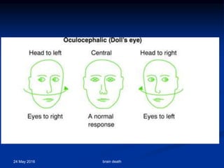 24 May 2016 brain death
 