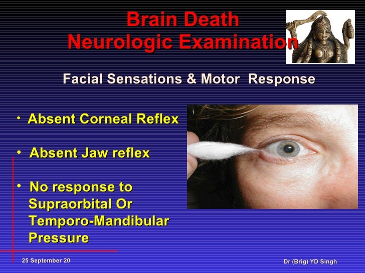 Brain death Present status YDS