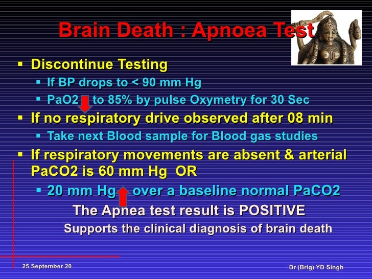 Brain death Present status YDS