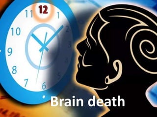 Brain death
 