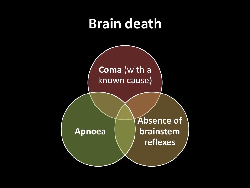 Brain death