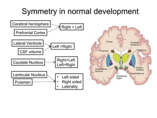 Symmetry in normal development
Cerebral hemisphere
Prefrontal Cortex
Right > Left
Left >Right
Lateral Ventricle
CSF volume
Right>Left
Left>Right
Caudate Nucleus
Lenticular Nucleus
Putamen
• Left sided
• Right sided
• Laterality
 