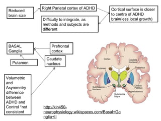 Reduced
brain size
Right Parietal cortex of ADHD
Difficulty to integrate, as
methods and subjects are
different
Cortical surface is closer
to centre of ADHD
brain(less local growth)
BASAL
Ganglia
Prefrontal
cortex
Caudate
nucleusPutamen
Volumetric
and
Asymmetry
difference
between
ADHD and
Control *not
consistent
http://kin450-
neurophysiology.wikispaces.com/Basal+Ga
nglia+II
 