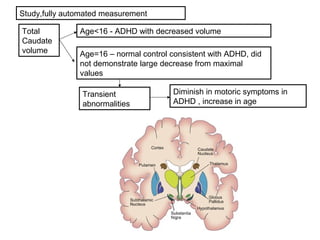 Total
Caudate
volume
Study,fully automated measurement
Age<16 - ADHD with decreased volume
Age=16 – normal control consistent with ADHD, did
not demonstrate large decrease from maximal
values
Transient
abnormalities
Diminish in motoric symptoms in
ADHD , increase in age
 