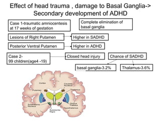Effect of head trauma , damage to Basal Ganglia->
Secondary development of ADHD
Complete elimination of
basal ganglia
Case 1-traumatic amniocentesis
at 17 weeks of gestation
Lesions of Right Putamen
Posterior Ventral Putamen
Higher in SADHD
Higher in ADHD
Case 2-
99 children(age4 -19)
Closed head injury Chance of SADHD
basal ganglia-3.2% Thalamus-3.6%
 