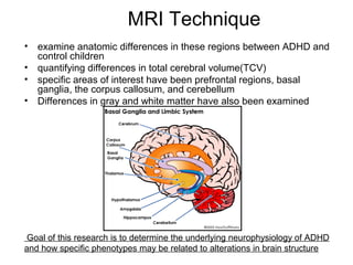 MRI Technique
• examine anatomic differences in these regions between ADHD and
control children
• quantifying differences in total cerebral volume(TCV)
• specific areas of interest have been prefrontal regions, basal
ganglia, the corpus callosum, and cerebellum
• Differences in gray and white matter have also been examined
Goal of this research is to determine the underlying neurophysiology of ADHD
and how specific phenotypes may be related to alterations in brain structure
 