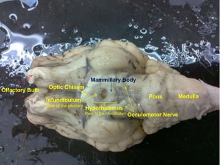 Brain dissection pictures | PPTX
