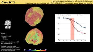 Herramienta para el soporte a la toma de deciones.
Caso Nº 2                                            Riesgo de que un paciente sufra DCL (CDR=0.5), en relación a una población patrón.




                                                                                                   Envejecimiento Normal             Alzheimer

                                                                                            100




                                                                                             75

                                                                         Texto
                                                                                             50



ESTUDIO
                                                                                             25
1942 sujetos (18-96 años)
   60% sanos
   40% Alzheimer                                                                              0
                                                                                                  20   30     40     50    60   70      80       90
Todos los sujetos con datos clínicos previos (CDR,
MMSE, Nivel sociocultural, etc)

Para cada RMI se han extraído 116 zonas
anatómicas y cada una de ellas ha sido estudiada
mediante diversos indicadores (grosor SG, volumen
SG, etc), creando mapas poblacionales.
 