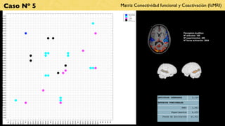 Caso Nº 5                                                                                                                                                                                                                                                                                          Matriz Conectividad funcional y Coactivación (fcMRI)
                                                                                                                                                                                                                                                                                                        BILATERAL
BA1
                                                                                                                                                                                                                                                                                                        L−>L
BA10                                                                                                                                                                                                                                                                                                    L−>R
                                                                                                                                                                                                                                                                                                        R−>L
BA11

BA13

BA17

BA18

BA19

BA2                                                                                                                                                                                                                                                                                                                                           Perception.Audition
BA20                                                                                                                                                                                                                                                                                                                                          Nº artículos: 100
BA21                                                                                                                                                                                                                                                                                                                                          Nº experimentos: 495
BA22                                                                                                                                                                                                                                                                                                                                          Nº focos activación: 2604
BA23

BA24

BA25

BA27

BA28

BA29

BA3

BA30

BA31

BA32

BA33

BA34

BA35

BA36

BA37

BA38

BA39

BA4

BA40

BA41

BA42

BA43

BA44                                                                                                                                                                                                                                                                                                                   ARTICULOS INDEXADOS            2,124
BA45

BA46                                                                                                                                                                                                                                                                                                                   ESTUDIOS FUNCIONALES
BA47

BA5                                                                                                                                                                                                                                                                                                                                      fMRI         1,563
BA6

BA7                                                                                                                                                                                                                                                                                                                              Experimentos         6,632
BA8

BA9
                                                                                                                                                                                                                                                                                                                          Focos de Activación        41,012
       BA1

             BA10

                    BA11

                           BA13

                                  BA17

                                         BA18

                                                BA19

                                                       BA2

                                                             BA20

                                                                    BA21

                                                                           BA22

                                                                                  BA23

                                                                                         BA24

                                                                                                BA25

                                                                                                       BA27

                                                                                                              BA28

                                                                                                                     BA29

                                                                                                                            BA3

                                                                                                                                  BA30

                                                                                                                                         BA31

                                                                                                                                                BA32

                                                                                                                                                       BA33

                                                                                                                                                              BA34

                                                                                                                                                                     BA35

                                                                                                                                                                            BA36

                                                                                                                                                                                   BA37

                                                                                                                                                                                          BA38

                                                                                                                                                                                                 BA39

                                                                                                                                                                                                        BA4

                                                                                                                                                                                                              BA40

                                                                                                                                                                                                                     BA41

                                                                                                                                                                                                                            BA42

                                                                                                                                                                                                                                   BA43

                                                                                                                                                                                                                                          BA44

                                                                                                                                                                                                                                                 BA45

                                                                                                                                                                                                                                                        BA46

                                                                                                                                                                                                                                                               BA47

                                                                                                                                                                                                                                                                      BA5

                                                                                                                                                                                                                                                                            BA6

                                                                                                                                                                                                                                                                                  BA7

                                                                                                                                                                                                                                                                                        BA8

                                                                                                                                                                                                                                                                                              BA9
 