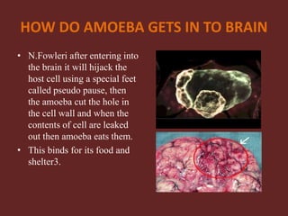 HOW DO AMOEBA GETS IN TO BRAIN
• N.Fowleri after entering into
the brain it will hijack the
host cell using a special feet
called pseudo pause, then
the amoeba cut the hole in
the cell wall and when the
contents of cell are leaked
out then amoeba eats them.
• This binds for its food and
shelter3.
 