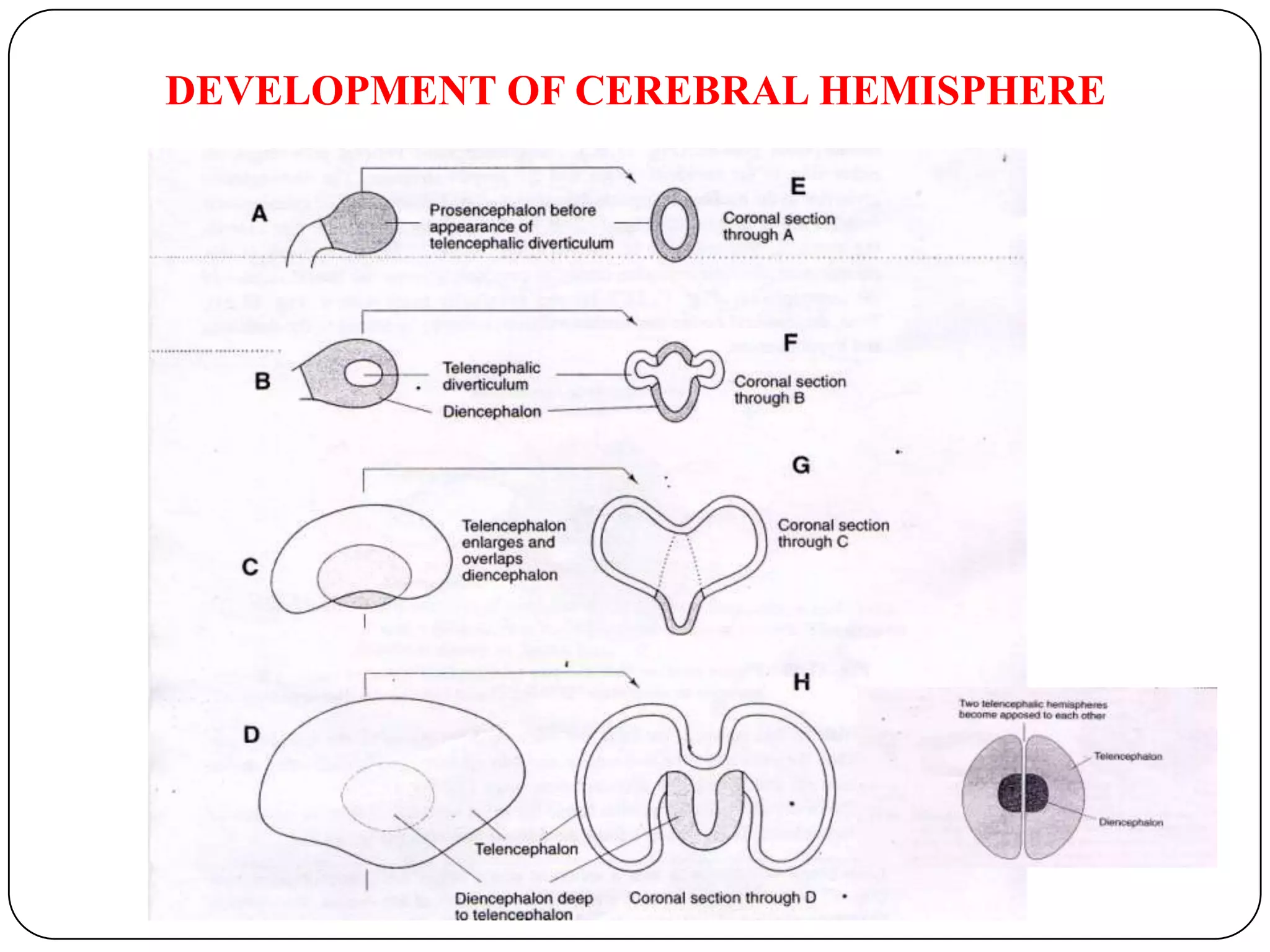 MOTOR &SENSORY CRANIAL NERVE NUCLEI OF THE PONS