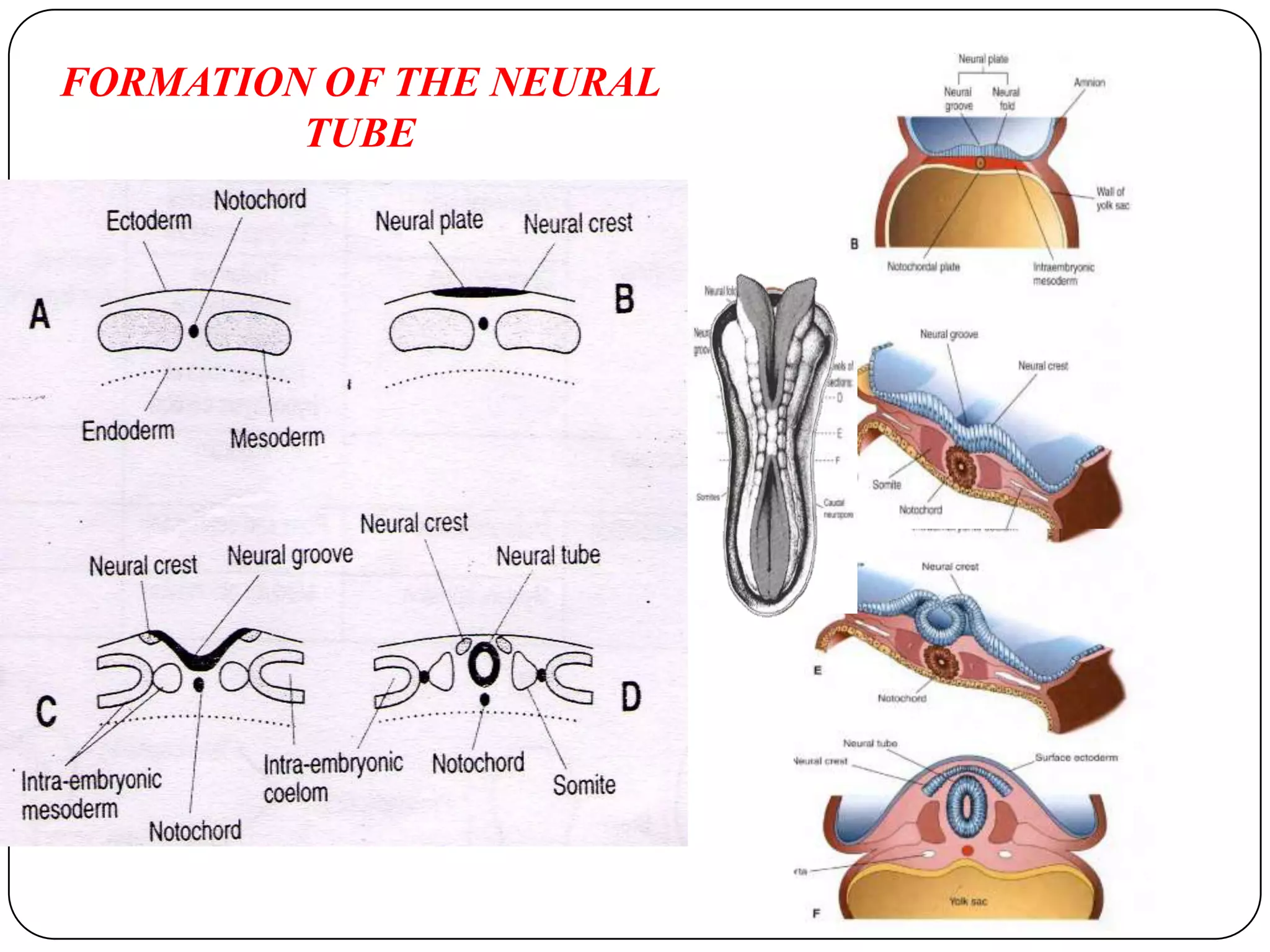 FORMATION OF THE NEURAL TUBE