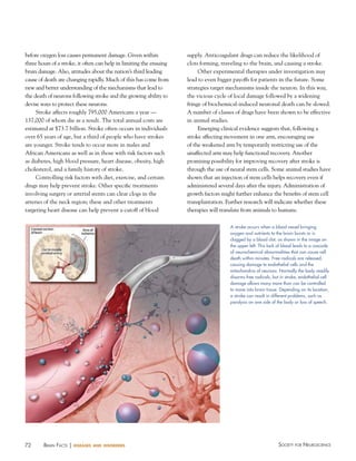 72 Society for NeuroScieNceBraiN factS | diseases and disorders
before oxygen loss causes permanent damage. Given within
three hours of a stroke, it often can help in limiting the ensuing
brain damage. Also, attitudes about the nation’s third leading
cause of death are changing rapidly. Much of this has come from
new and better understanding of the mechanisms that lead to
the death of neurons following stroke and the growing ability to
devise ways to protect these neurons.
Stroke affects roughly 795,000 Americans a year —
137,000 of whom die as a result. The total annual costs are
estimated at $73.7 billion. Stroke often occurs in individuals
over 65 years of age, but a third of people who have strokes
are younger. Stroke tends to occur more in males and
African Americans as well as in those with risk factors such
as diabetes, high blood pressure, heart disease, obesity, high
cholesterol, and a family history of stroke.
Controlling risk factors with diet, exercise, and certain
drugs may help prevent stroke. Other specific treatments
involving surgery or arterial stents can clear clogs in the
arteries of the neck region; these and other treatments
targeting heart disease can help prevent a cutoff of blood
supply. Anticoagulant drugs can reduce the likelihood of
clots forming, traveling to the brain, and causing a stroke.
Other experimental therapies under investigation may
lead to even bigger payoffs for patients in the future. Some
strategies target mechanisms inside the neuron. In this way,
the vicious cycle of local damage followed by a widening
fringe of biochemical-induced neuronal death can be slowed.
A number of classes of drugs have been shown to be effective
in animal studies.
Emerging clinical evidence suggests that, following a
stroke affecting movement in one arm, encouraging use
of the weakened arm by temporarily restricting use of the
unaffected arm may help functional recovery. Another
promising possibility for improving recovery after stroke is
through the use of neural stem cells. Some animal studies have
shown that an injection of stem cells helps recovery even if
administered several days after the injury. Administration of
growth factors might further enhance the benefits of stem cell
transplantation. Further research will indicate whether these
therapies will translate from animals to humans.
A stroke occurs when a blood vessel bringing
oxygen and nutrients to the brain bursts or is
clogged by a blood clot, as shown in the image on
the upper left. This lack of blood leads to a cascade
of neurochemical abnormalities that can cause cell
death within minutes. Free radicals are released,
causing damage to endothelial cells and the
mitochondria of neurons. Normally the body readily
disarms free radicals, but in stroke, endothelial cell
damage allows many more than can be controlled
to move into brain tissue. Depending on its location,
a stroke can result in different problems, such as
paralysis on one side of the body or loss of speech.
 