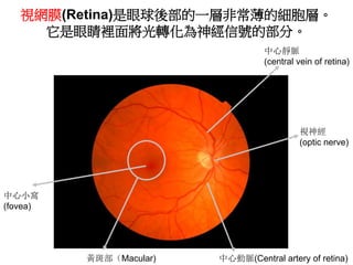 視網膜(Retina)是眼球後部的一層非常薄的細胞層。
它是眼睛裡面將光轉化為神經信號的部分。
黃斑部（Macular) 中心動脈(Central artery of retina)
中心靜脈
(central vein of retina)
...