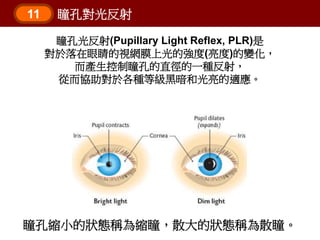 11 瞳孔對光反射
瞳孔光反射(Pupillary Light Reflex, PLR)是
對於落在眼睛的視網膜上光的強度(亮度)的變化，
而產生控制瞳孔的直徑的一種反射，
從而協助對於各種等級黑暗和光亮的適應。
瞳孔縮小的狀態稱為縮瞳，散大的...