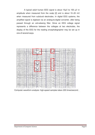 A typical adult human EEG signal is about 10µV to 100 µV in
   amplitude when measured from the scalp [2] and is about 10–20 mV
   when measured from subdural electrodes. In digital EEG systems, the
   amplified signal is digitized via an analog-to-digital converter, after being
   passed through an anti-aliasing filter. Since an EEG voltage signal
   represents a difference between the voltages at two electrodes, the
   display of the EEG for the reading encephalographer may be set up in
   one of several ways.




Computer waveform analysis: high-speed samples taken 200 times/second .




Department of Computer Science                                                     Page 8
 