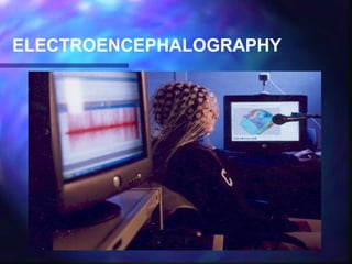 ELECTROENCEPHALOGRAPHY
 
