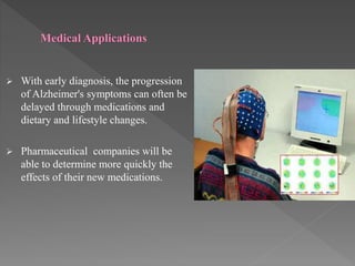Medical Applications
 With early diagnosis, the progression
of Alzheimer's symptoms can often be
delayed through medications and
dietary and lifestyle changes.
 Pharmaceutical companies will be
able to determine more quickly the
effects of their new medications.
 
