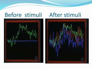 Before stimuli After stimuli
 