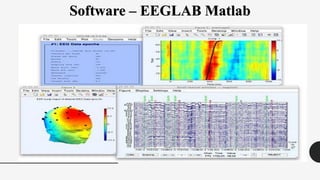Software – EEGLAB Matlab
 