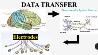 DATA TRANSFER
Electrodes
 