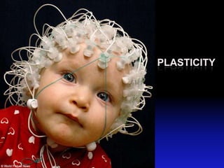PLASTICITY
 