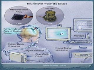 8/4/2015 10Braingate Technology
 
