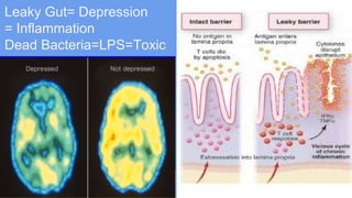 Leaky Gut= Depression
= Inflammation
Dead Bacteria=LPS=Toxic
 