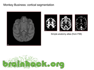Monkey Business: cortical segmentation




                                   Simple anatomy atlas (from F99)
 