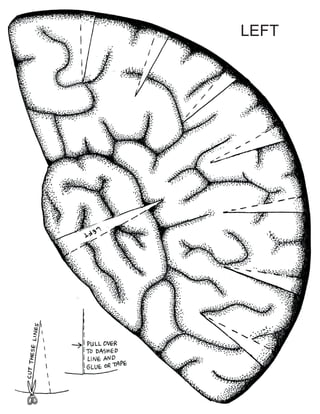 Brain hatbw