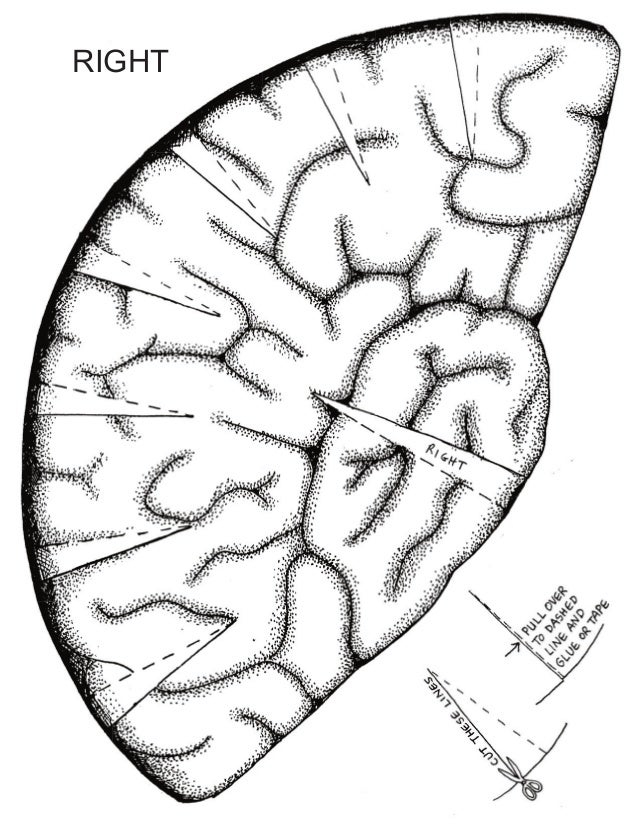 Brain hatbw