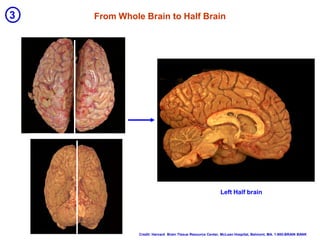 Neo Cortex Brain Image An Introduction to Human Neuroanatomy & The Neocortex | PDF