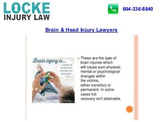604-336-8840
Brain & Head Injury Lawyers
 