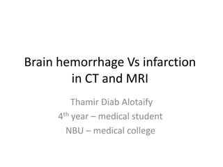 Brain hemorrhage Vs infarction
in CT and MRI
Thamir Diab Alotaify
4th year – medical student
NBU – medical college

 