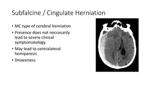 Subfalcine / Cingulate Herniation
• MC type of cerebral herniation
• Presence does not neccesarily
lead to severe clinical
symptomatology.
• May lead to contralateral
hemiparesis
• Drowsiness
 