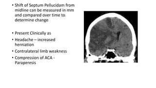 • Shift of Septum Pellucidam from
midline can be measured in mm
and compared over time to
determine change
• Present Clinically as
• Headache – increased
herniation
• Contralateral limb weakness
• Compression of ACA -
Paraperesis
 