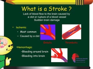 Lack of blood flow to the brain caused by  a clot or rupture of a blood vessel Sudden brain damage Ischemic Most common Caused by a clot What is a Stroke ? Embolic Thrombotic Hemorrhagic Bleeding around brain Bleeding into brain 