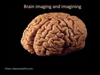 Brain imaging and imagining
Photo: aboutmodafinil.com
 