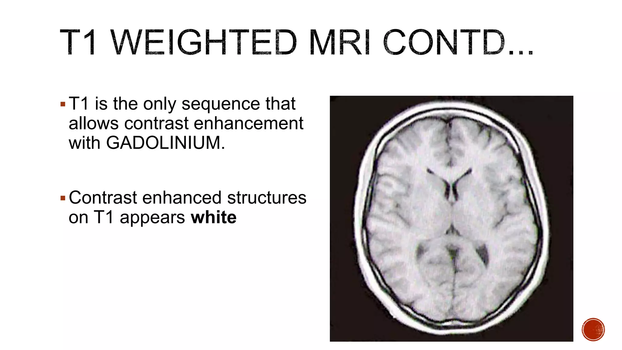 T1 is the only sequence that
allows contrast enhancement
with GADOLINIUM.
Contrast enhanced structures
on T1 appears white
 