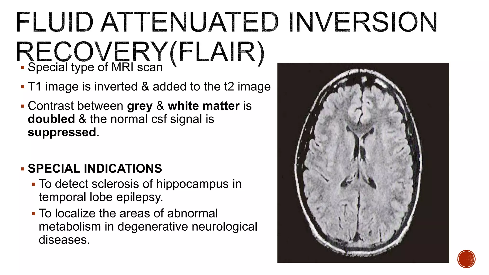  Special type of MRI scan
 T1 image is inverted & added to the t2 image
 Contrast between grey & white matter is
doubled & the normal csf signal is
suppressed.
 SPECIAL INDICATIONS
 To detect sclerosis of hippocampus in
temporal lobe epilepsy.
 To localize the areas of abnormal
metabolism in degenerative neurological
diseases.
 