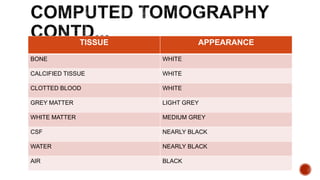 TISSUE APPEARANCE
BONE WHITE
CALCIFIED TISSUE WHITE
CLOTTED BLOOD WHITE
GREY MATTER LIGHT GREY
WHITE MATTER MEDIUM GREY
CSF NEARLY BLACK
WATER NEARLY BLACK
AIR BLACK
 