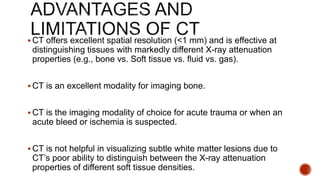  CT offers excellent spatial resolution (<1 mm) and is effective at
distinguishing tissues with markedly different X-ray attenuation
properties (e.g., bone vs. Soft tissue vs. fluid vs. gas).
 CT is an excellent modality for imaging bone.
 CT is the imaging modality of choice for acute trauma or when an
acute bleed or ischemia is suspected.
 CT is not helpful in visualizing subtle white matter lesions due to
CT’s poor ability to distinguish between the X-ray attenuation
properties of different soft tissue densities.
 