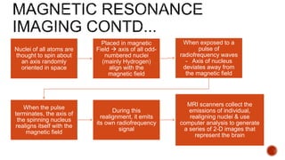 Nuclei of all atoms are
thought to spin about
an axis randomly
oriented in space
Placed in magnetic
Field  axis of all odd-
numbered nuclei
(mainly Hydrogen)
align with the
magnetic field
When exposed to a
pulse of
radiofrequency waves
- Axis of nucleus
deviates away from
the magnetic field
When the pulse
terminates, the axis of
the spinning nucleus
realigns itself with the
magnetic field
During this
realignment, it emits
its own radiofrequency
signal
MRI scanners collect the
emissions of individual,
realigning nuclei & use
computer analysis to generate
a series of 2-D images that
represent the brain
 