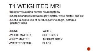 Best for visualizing normal neuroanatomy
Sharp boundaries between grey matter, white matter, and csf
Useful in evaluation of cerebro-pontine angle, cistern &
pituitary fossa
BONE WHITE
WHITE MATTER LIGHT GREY
GREY MATTER MEDIUM GREY
WATER/CSF/AIR BLACK
 