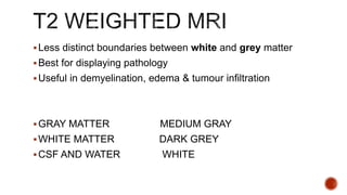 Less distinct boundaries between white and grey matter
Best for displaying pathology
Useful in demyelination, edema & tumour infiltration
GRAY MATTER MEDIUM GRAY
WHITE MATTER DARK GREY
CSF AND WATER WHITE
 