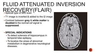  Special type of MRI scan
 T1 image is inverted & added to the t2 image
 Contrast between grey & white matter is
doubled & the normal csf signal is
suppressed.
 SPECIAL INDICATIONS
 To detect sclerosis of hippocampus in
temporal lobe epilepsy.
 To localize the areas of abnormal
metabolism in degenerative neurological
diseases.
 