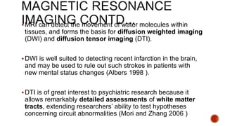 MRI can detect the movement of water molecules within
tissues, and forms the basis for diffusion weighted imaging
(DWI) and diffusion tensor imaging (DTI).
DWI is well suited to detecting recent infarction in the brain,
and may be used to rule out such strokes in patients with
new mental status changes (Albers 1998 ).
DTI is of great interest to psychiatric research because it
allows remarkably detailed assessments of white matter
tracts, extending researchers’ ability to test hypotheses
concerning circuit abnormalities (Mori and Zhang 2006 )
 
